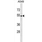 Homocysteine-Responsive Endoplasmic Reticulum-Resident Ubiquitin-Like Domain Member 2 Protein (HERPUD2) Antibody