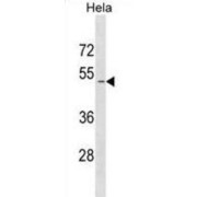 Mothers Against Decapentaplegic Homolog 1 (SMAD1) Antibody