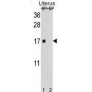SH3 Domain Binding Glutamic Acid Rich Protein Like Protein (SH3BGRL) Antibody