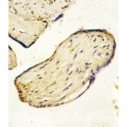 abx031411