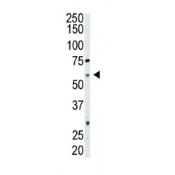 5'-Nucleotidase / CD73 (NT5E) Antibody