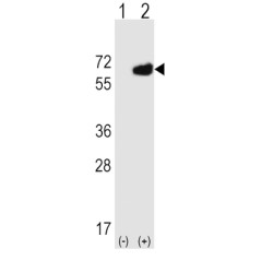 5'-Nucleotidase / CD73 (NT5E) Antibody