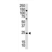 Podoplanin / GP36 / T1A-2 Antibody