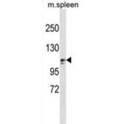WB analysis of mouse spleen tissue.