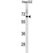 SV2 Related Protein (SVOP) Antibody