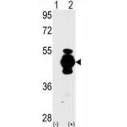 Glial Fibrillary Acidic Protein (GFAP) Antibody