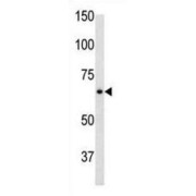 Glial Fibrillary Acidic Protein (GFAP) Antibody