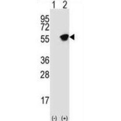 Glial Fibrillary Acidic Protein (GFAP) Antibody
