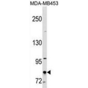 Cutaneous T-Cell Lymphoma-Associated Antigen 1 (CTAGE1) Antibody