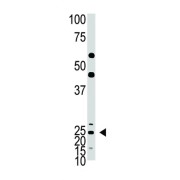 Achaete-Scute Homolog 1 (ASCL1) Antibody