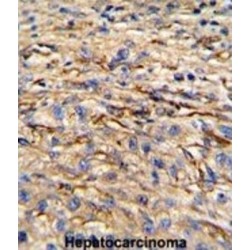 Nestin (NES) Antibody