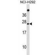 Mannose-P-Dolichol Utilization Defect 1 Protein (MPDU1) Antibody