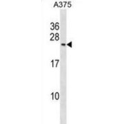 DNA-Directed RNA Polymerase II Subunit RPB7 (POLR2G) Antibody