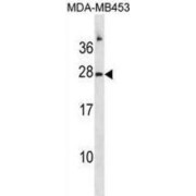 Ribonuclease A (RNASE1) Antibody