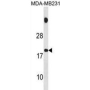 SPNXB Antibody