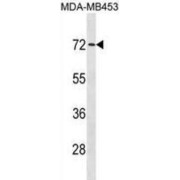 RING-Type E3 Ubiquitin Transferase MEX3C (MEX3C) Antibody