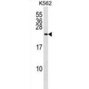 RAB27A, Member RAS Oncogene Family (RAB27A) Antibody
