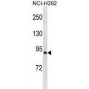 Acyl-CoA Synthetase Long-Chain Family Member 1 (ACSL1) Antibody