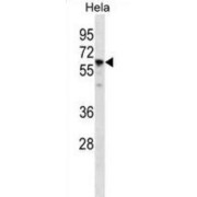 T-Complex Protein 1 Subunit Eta (CCT7) Antibody