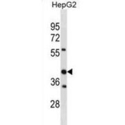 Stomatin Like 2 (STOML2) Antibody