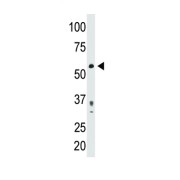 Pyruvate Dehydrogenase Complex Component X (PDHX) Antibody