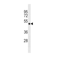 Pyruvate Dehydrogenase Complex Component X (PDHX) Antibody