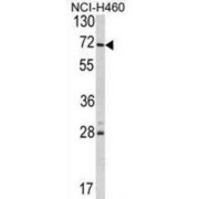 Ubiquitin Carboxyl-Terminal Hydrolase 21 (USP21) Antibody