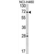 Ubiquitin Carboxyl-Terminal Hydrolase 21 (USP21) Antibody