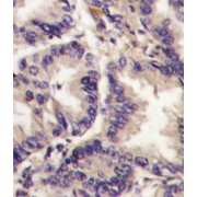 Vascular Endothelial Growth Factor C (VEGFC) Antibody