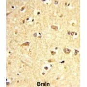 Transcription Factor SOX-4 (SOX4) Antibody