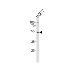 Transcription Factor SOX-4 (SOX4) Antibody