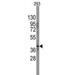 Transcription Factor SOX-2 (SOX2) Antibody