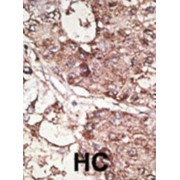 abx031507