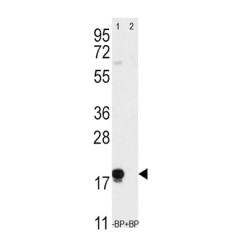 Thy-1 Membrane Glycoprotein (THY1) Antibody