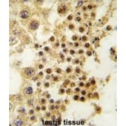Growth Differentiation Factor 3 (GDF3) Antibody