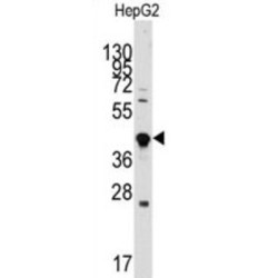 Growth Differentiation Factor 3 (GDF3) Antibody