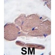 Myostatin (MSTN) Antibody