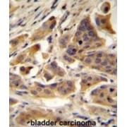 RanBP-Type And C3HC4-Type Zinc Finger-Containing Protein 1 (RBCK1) Antibody