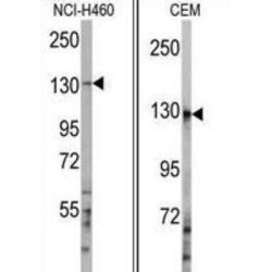 Ubiquitin Conjugation Factor E4 A (UBE4A) Antibody