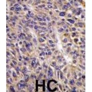 Ubiquitin/ISG15-Conjugating Enzyme E2 L6 (UBE2L6) Antibody