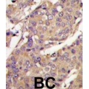 Ubiquitin/ISG15-Conjugating Enzyme E2 L6 (UBE2L6) Antibody