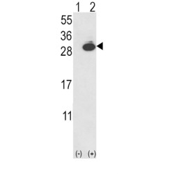 Ubiquitin Carboxyl Terminal Hydrolase L1 (UCHL1) Antibody