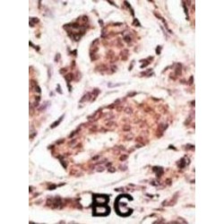 Ubiquitin Carboxyl Terminal Hydrolase L1 (UCHL1) Antibody