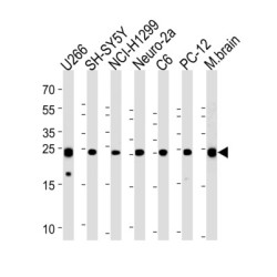 Ubiquitin Carboxyl Terminal Hydrolase L1 (UCHL1) Antibody