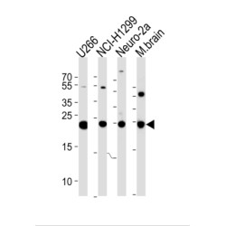 Ubiquitin Carboxyl Terminal Hydrolase L1 (UCHL1) Antibody
