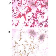 abx031537