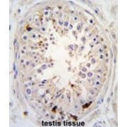 Ubiquitin Carboxyl-Terminal Hydrolase 2 (USP2) Antibody