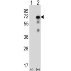 Ubiquitin Carboxyl-Terminal Hydrolase 2 (USP2) Antibody