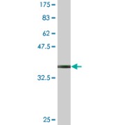 Protocadherin-10 (PCDH10) Antibody