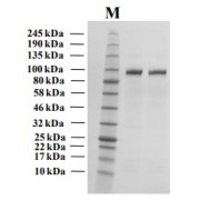 SDS-PAGE analysis of recombinant Human Autotaxin (ATX) Protein.